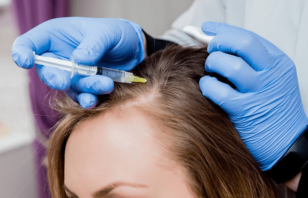 PRP - MSG Hair Loss Clinic